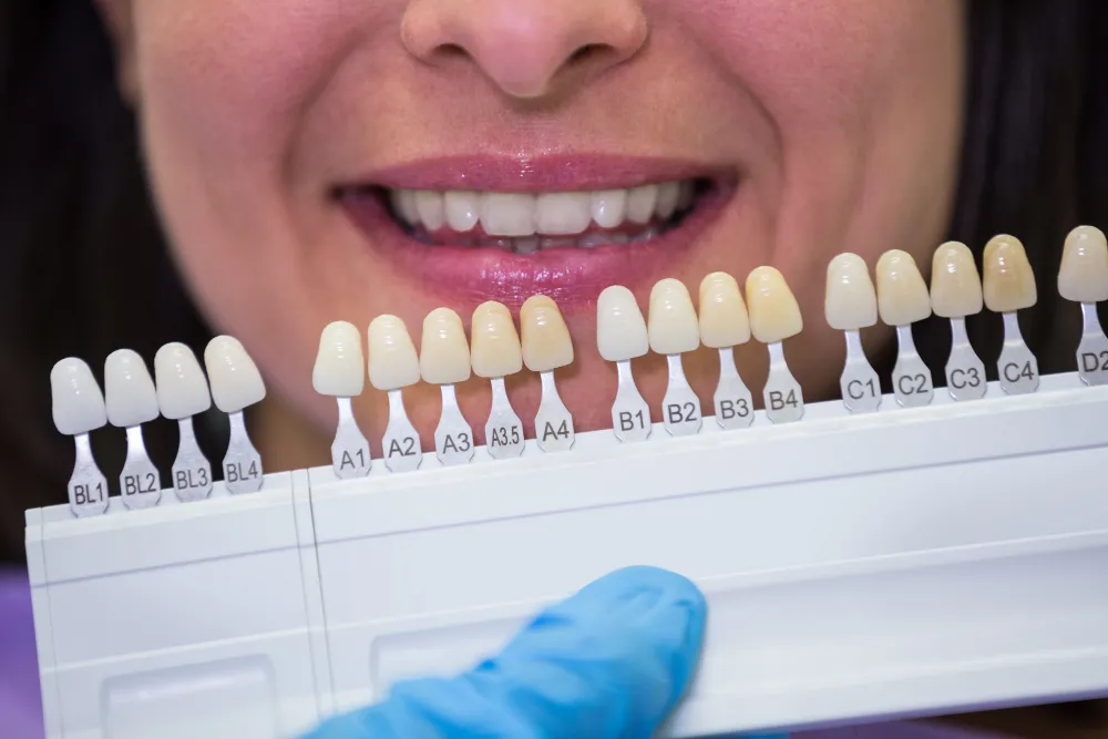 Dentist holding a tooth shade guide next to a patient’s smile