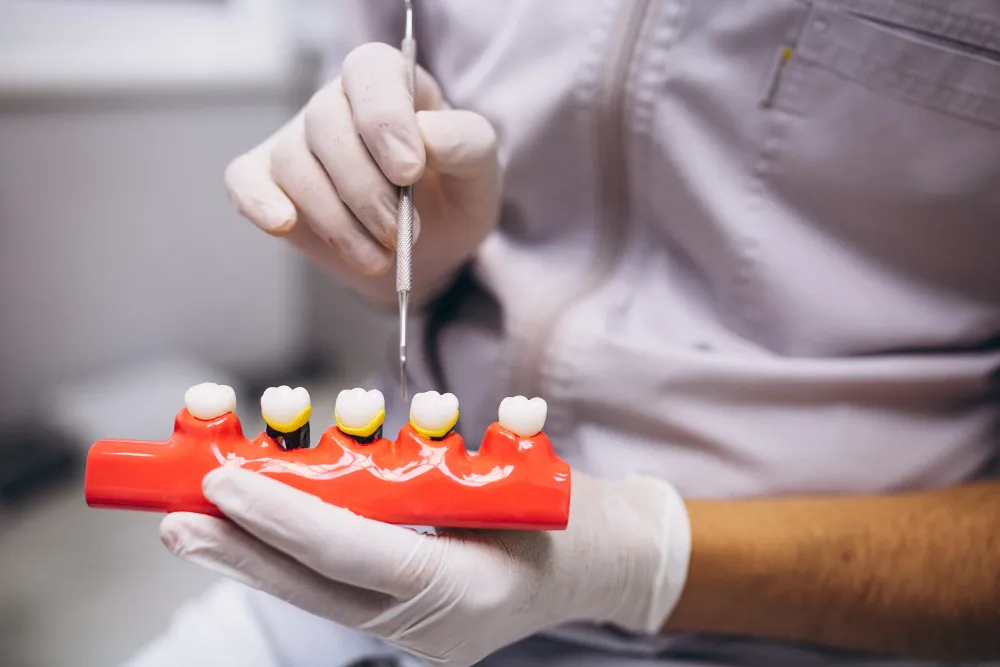Dentist holding a model of a dental bridge on a row of teeth